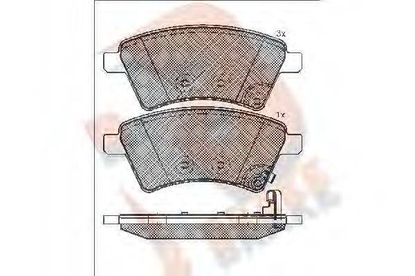 R BRAKE RB1758 Комплект гальмівних колодок, дискове гальмо